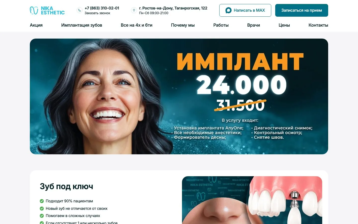 Сайт Nika Esthetic: имплантация